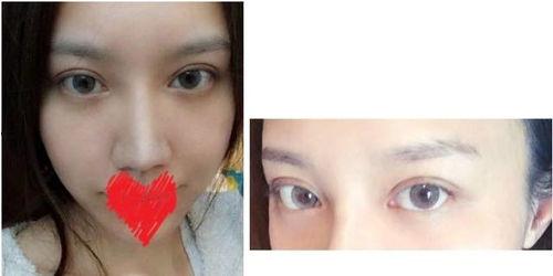 做完眼皮是否可以吃瓜,美味瓜果的等待时光